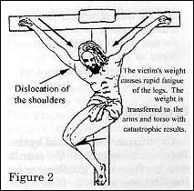 crucifixion 2