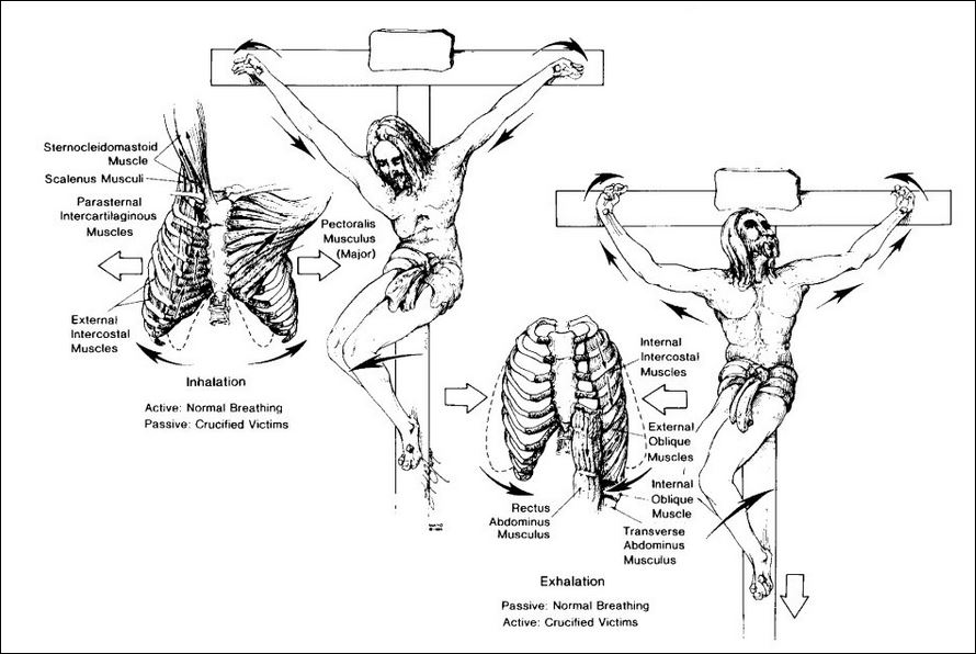 crucifixion 6
